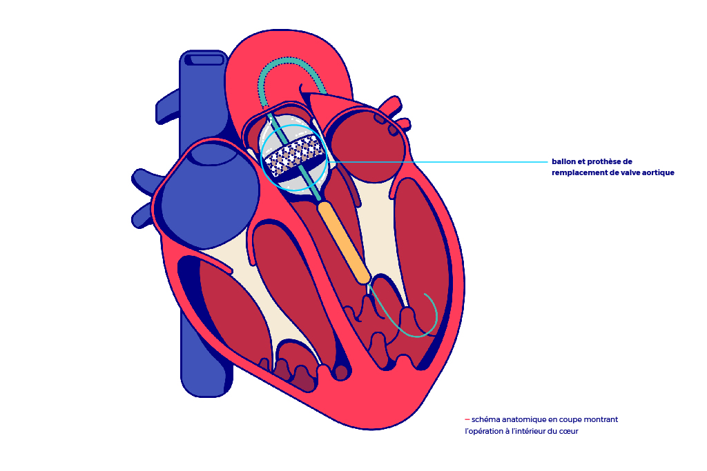 anatomie-coeur2